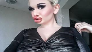 “Barbie humana” anuncia que aumentará el tamaño de sus labios | FOTOS 