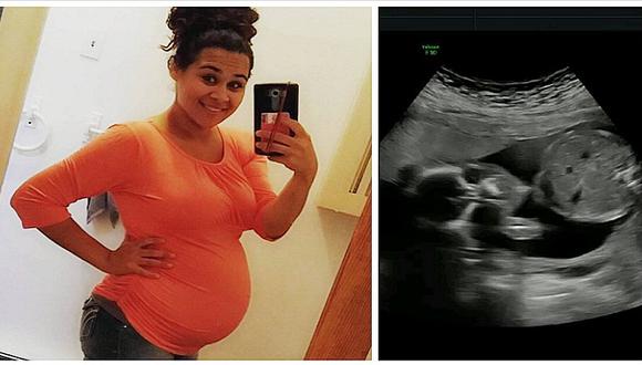 Instagram: bebé prematuro nace en su saco amniótico dentro de auto (FOTO)
