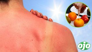 ¿Qué alimentos ayudan a proteger la piel de los rayos solares?   