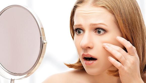 ¿Cómo combatir el acné? Cinco tratamientos que te pueden ayudar