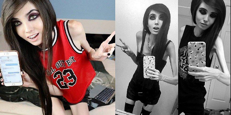 YouTube: Piden que cierre canal de joven de 27 kilos por inducir a la anorexia