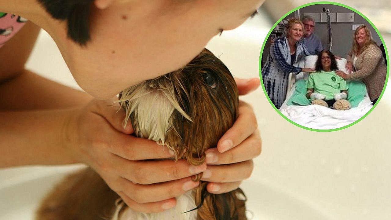 Mujer pierde piernas y manos por una infección que contrajo de su perro | FOTOS