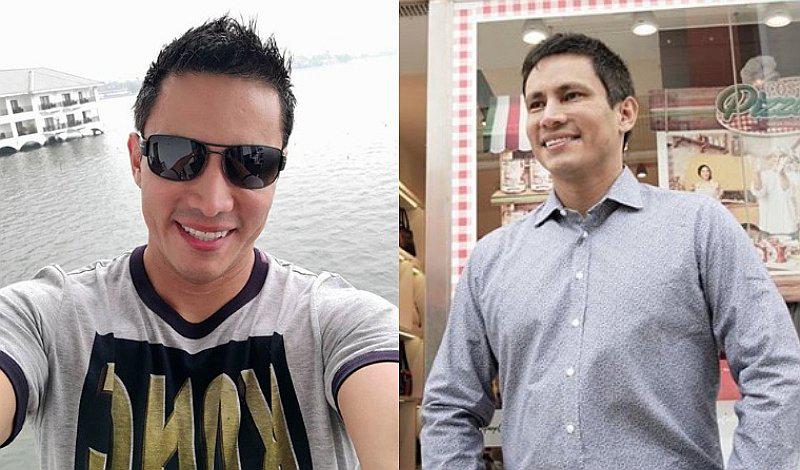 Renzo Costa: ¿qué le pasó a sus cejas? [FOTO] 