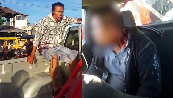 ¡Terrible! Hombre llega a hospital de Iquitos con cuchillo en la cabeza (VIDEO)