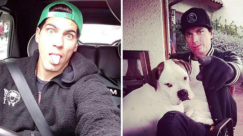 Ignacio Lastra muestra por primera vez su cuerpo tras quemarse al 90% (VIDEO)