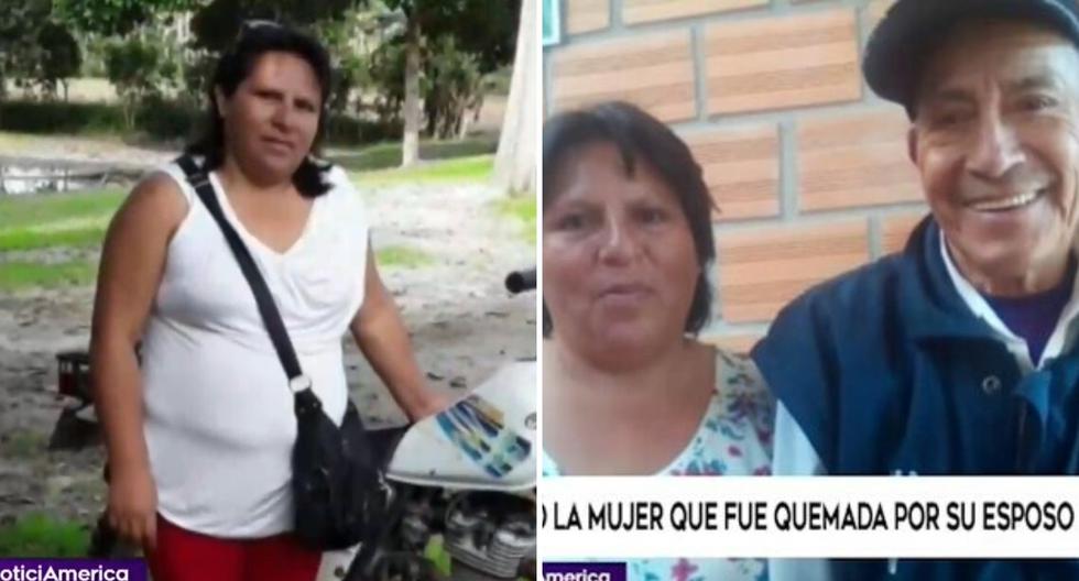 Murió La Mujer Que Fue Quemada Por Su Esposo Mientras Dormía│video Ojo Web Regionales Ojo 