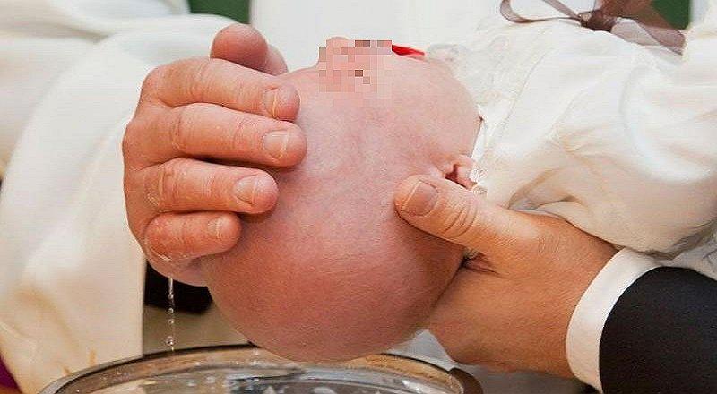 Por una inflamación en el ojo, descubren que bebé había sido contagiado de herpes