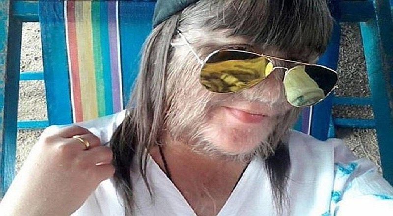 'Niña lobo' muestra su rostro afeitado (FOTOS) 