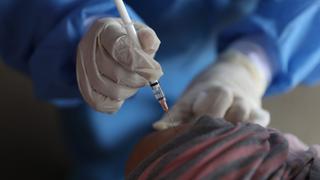 Minsa: Esta semana debe estar saliendo el plan de vacunación contra la viruela del mono 