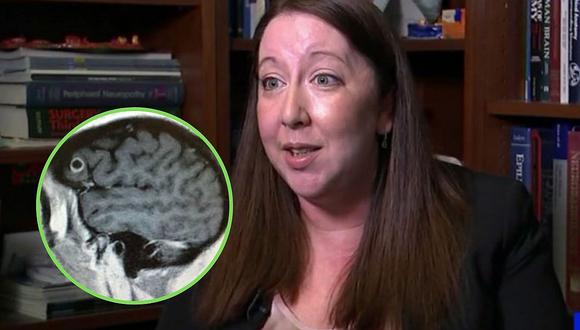 Mujer es diagnosticada con cáncer en el cerebro, pero descubren que tenía un gusano