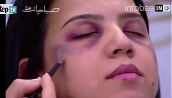Programa de televisión “enseñó” a mujeres cómo maquillarse los golpes