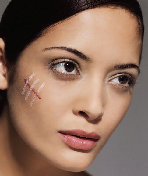 3 Tips caseros y efectivos para borrar cicatríces