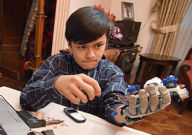 Leonardo Viscarra tiene 14 años y fabricó su propia mano robótica [FOTOS]