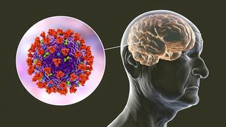 Coronavirus encoge cerebro y materia gris se reduce en regiones relacionadas con olfato y memoria