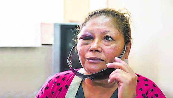 Los Olivos: Borracho golpea y acuchilla a su mamá