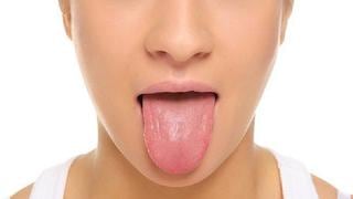 ¿Qué revela el color de la lengua sobre la salud?