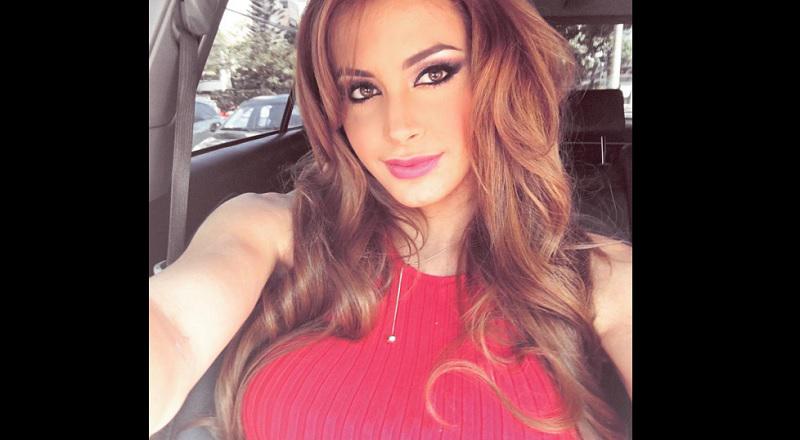 Milett tiene hasta este día para recuperarse o será sacada del Miss Perú