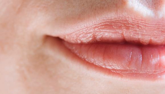 Protege tus labios de las bajas temperaturas del invierno. (Foto: Pexels)