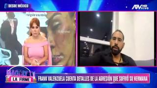 Frank Valenzuela sobre agresiones de Eleazar Gómez hacia su hermana Tefi: “Está viva de suerte” 