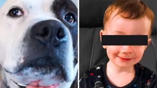 Madre en Reino Unido cuenta cómo su Bull Terrier le mordió el rostro a su bebé de dos años