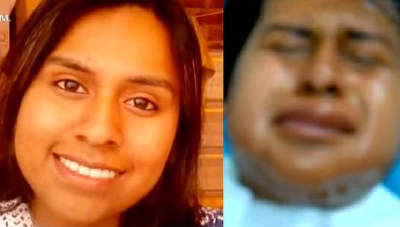 ​Magdalena: mujer queda desfigurada tras someterse a depilación láser