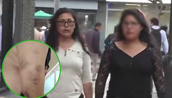 Mujer escapó de La Oroya luego que su ex pareja intentara matarla y pide ayuda (VIDEO)