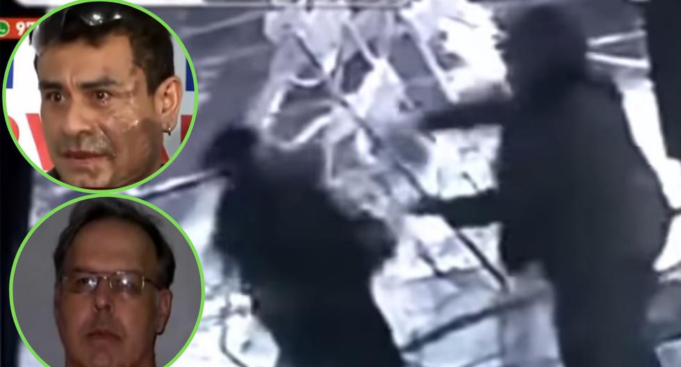 Peruano es atacado con ácido por norteamericano: "lárgate ...
