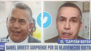 Daniel Urresti sorprende con su “rejuvenecido” rostro y ahora lo llaman “Capitán Bótox” | FOTOS