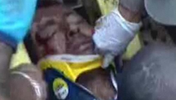 Brasil: Hombre sobrevivió tras 16 horas sepultado 