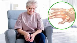 Osteoartritis, una enfermedad que afecta al 80% de personas mayores de 75 años