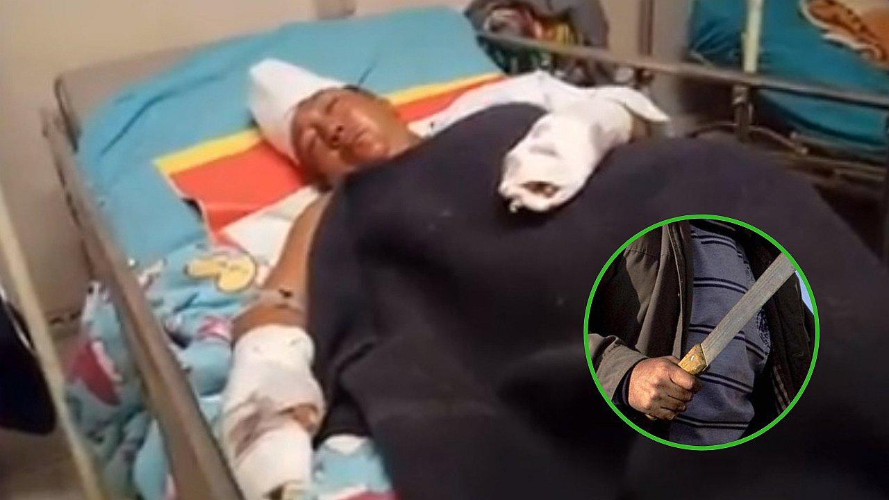 Sujeto ataca a machetazos a su suegra porque su expareja no quería retomar relación