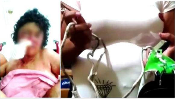 La Libertad: Se negó a tener intimidad y su pareja la agredió brutalmente (VIDEO)