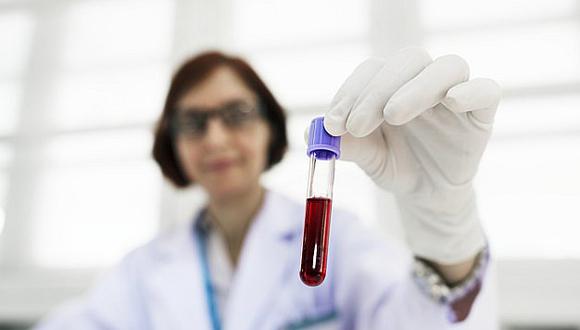 Inventan nuevo test que detecta hasta siete tipos de cáncer con solo una muestra de sangre