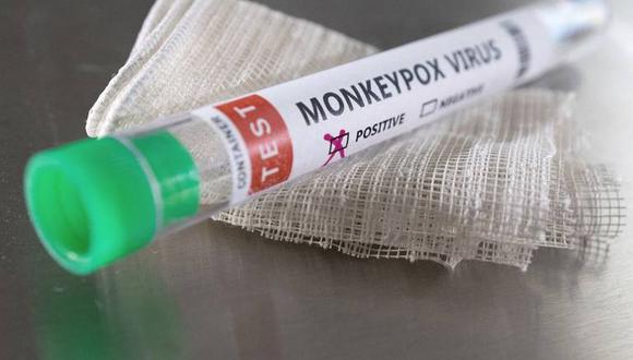 El viceministro de Salud indicó que los kits serológicos para detectar casos de viruela del mono estarán llegando a los países en los siguientes días. (Foto referencial: Reuters)