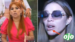 Magaly aconseja a Sheyla Rojas demandar a quienes “le han deformado” la cara tras retoquitos
