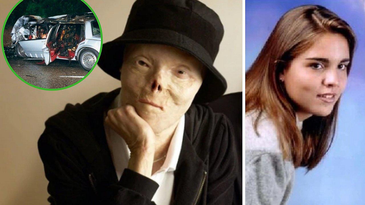 Muere venezolana que fue símbolo de campañas contra conductores ebrios