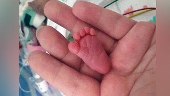 Bebé es herido con bisturí en el rostro durante cesárea, mientras mamita falleció 