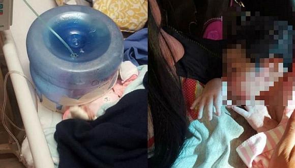 Ponen a bebé recién nacido un bidón de agua como incubadora 