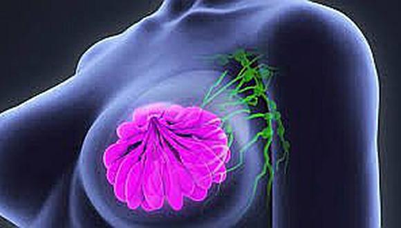 ​Científicos descubren enzima clave en proliferación del cáncer de mama