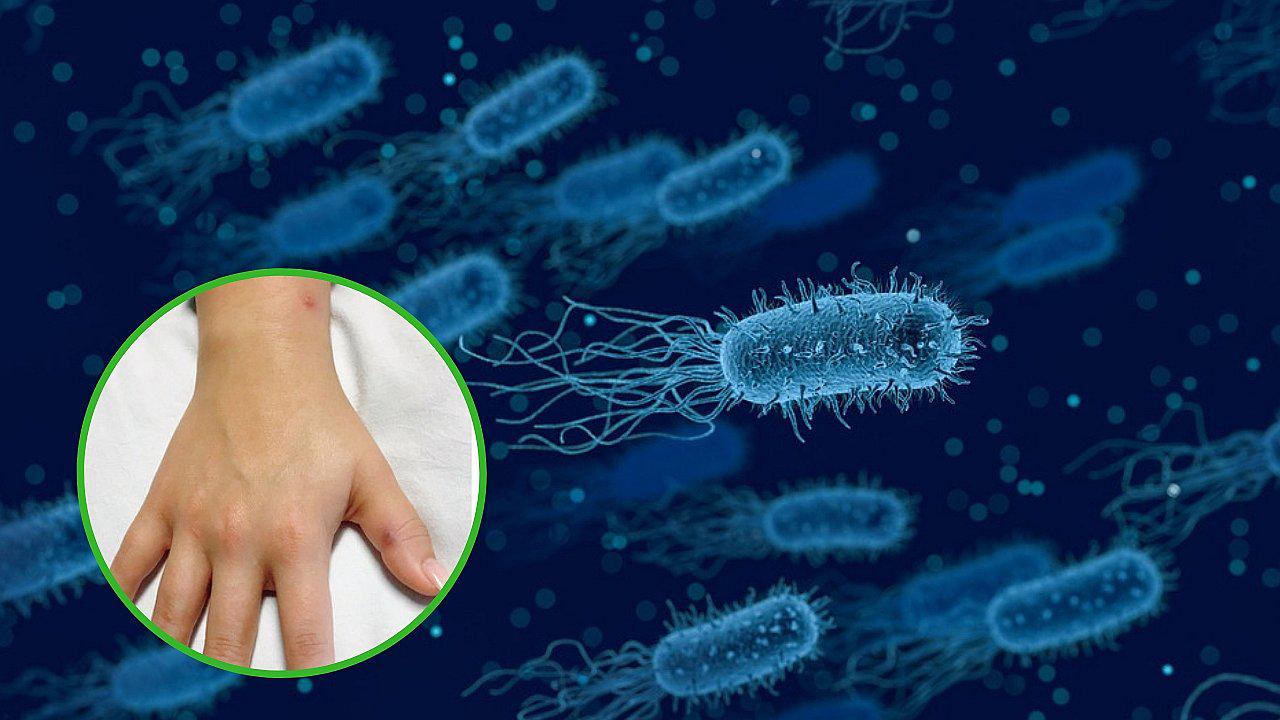 Joven va al médico por erupciones en la piel y le diagnostican una ETS (VIDEO)