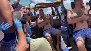 Pequeño tiburón se aferra al brazo de un hombre por 45 minutos en playa de Florida