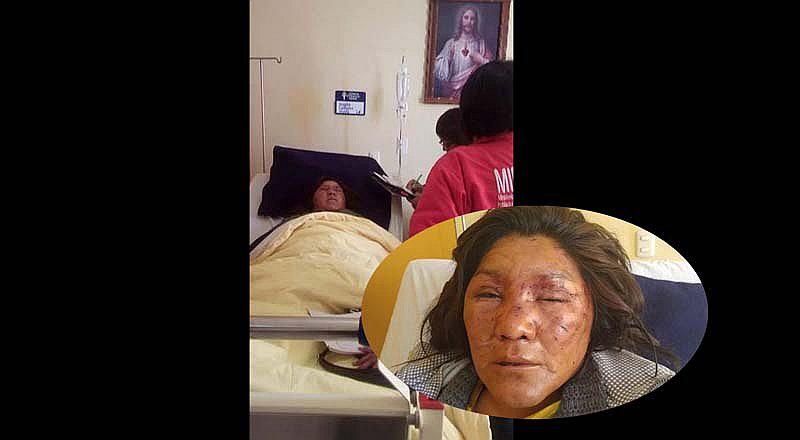 Puno: La golpea e intenta sacarle los ojos delante de su hijita [FOTOS] 