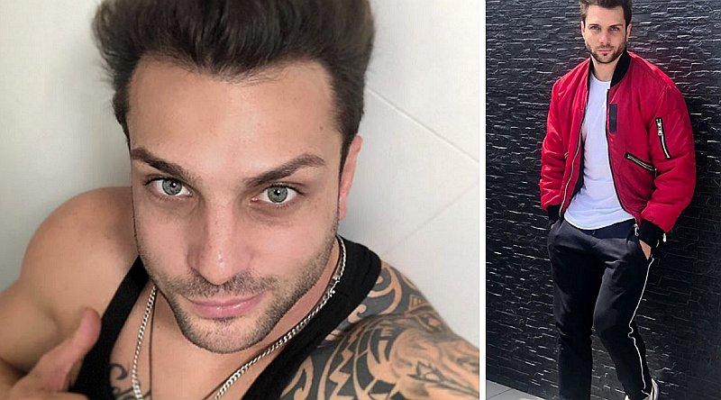 Nicola Porcella se opera la nariz y muestran el resultado | FOTOS