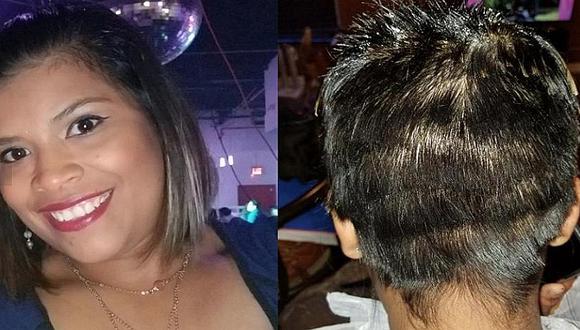 Mujer va a hacerse 'rayitos' a peluquería y termina con grave lesión de por vida (FOTOS)
