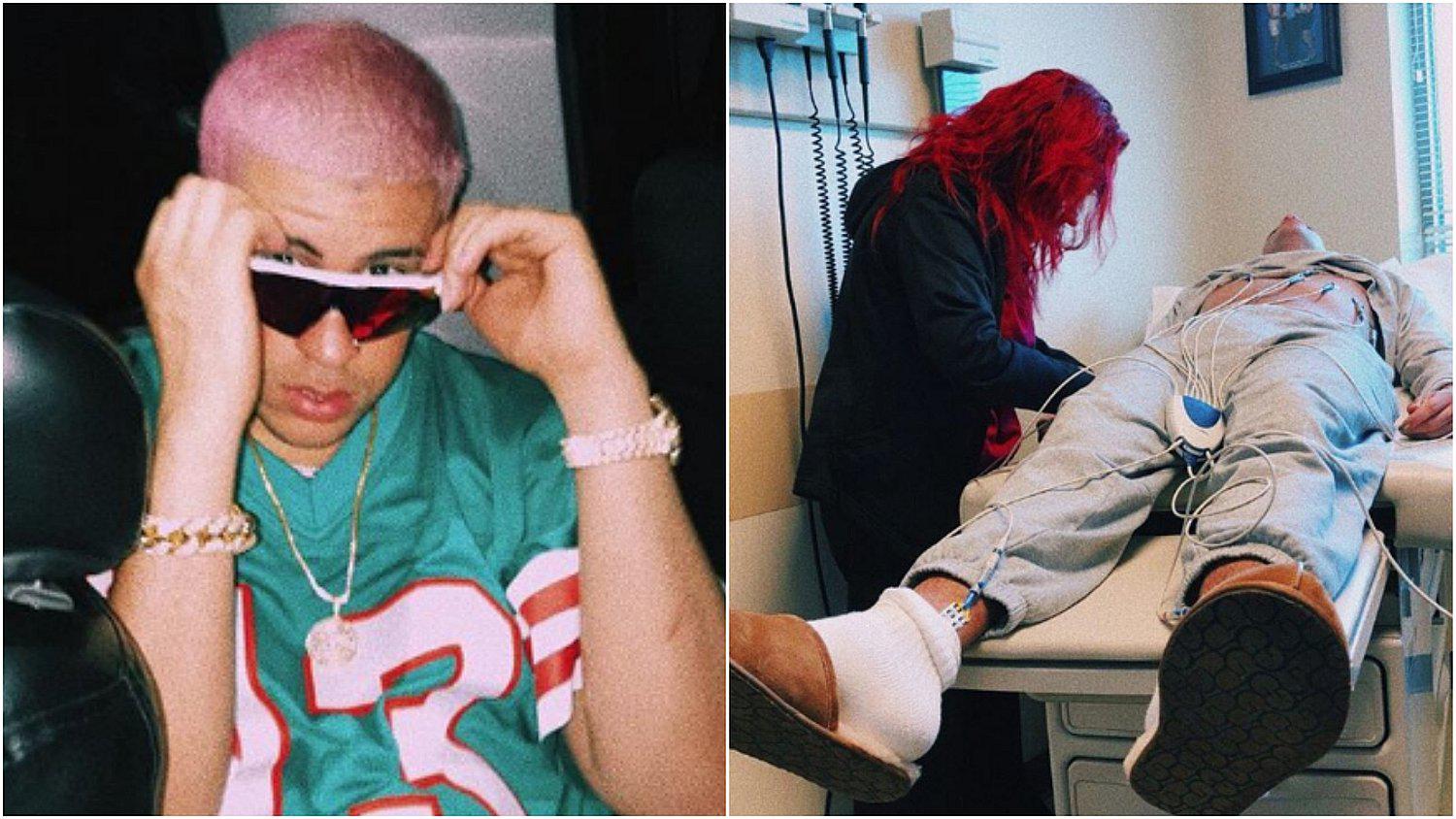 Bad Bunny preocupa a sus fans con foto en camilla de hospital