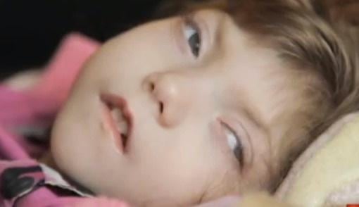 El caso de la niña que no envejece