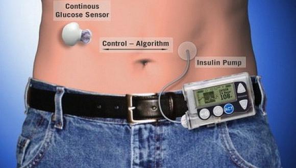 Un "páncreas artificial" para diabéticos asocia insulina y teléfonos móviles 
