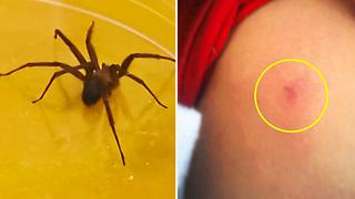 Cuidado con la araña casera: ¿qué hacer en caso de una mordedura?  