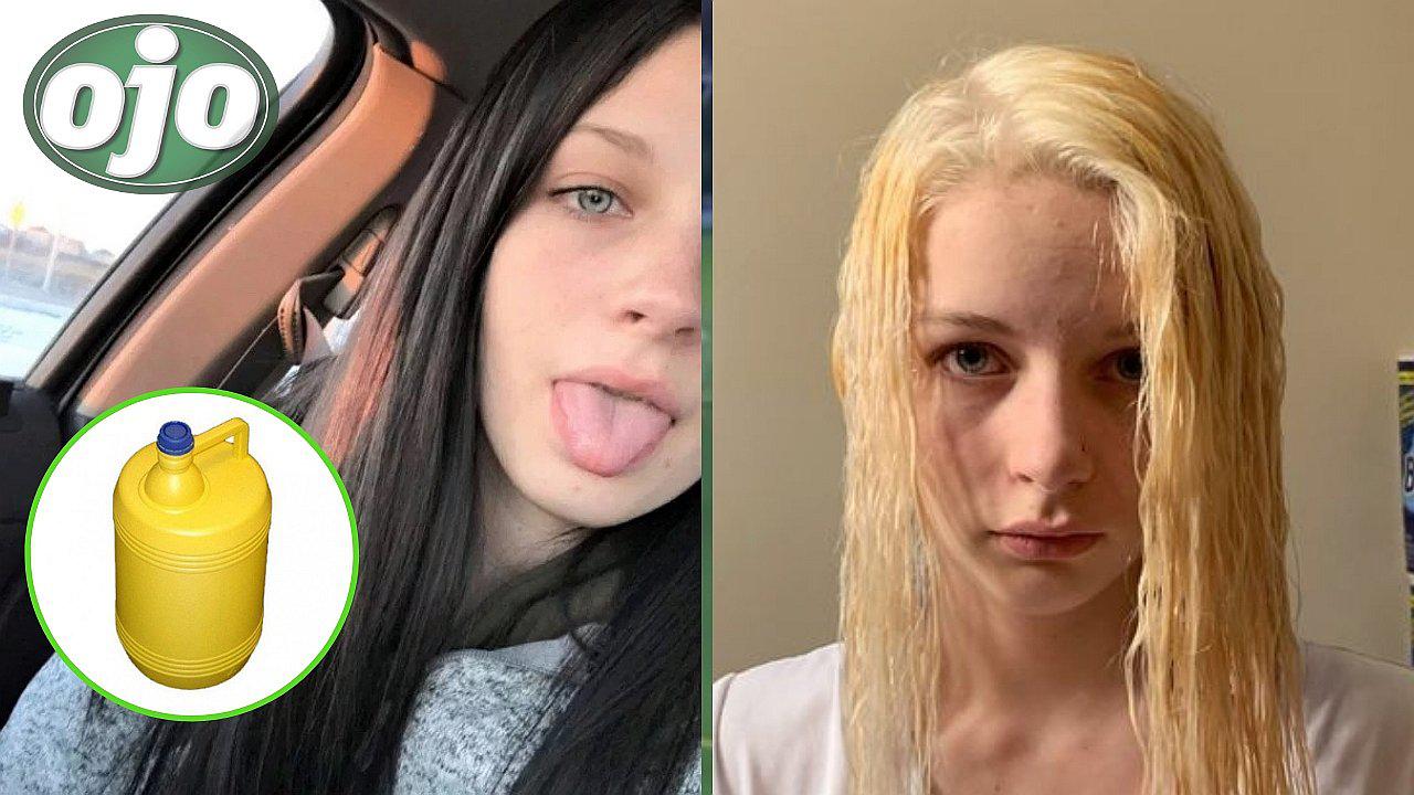 No le gustó el nuevo color de su cabello y decide utilizar lejía para decolorarlo