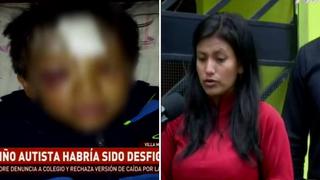 Niño con habilidades diferentes queda desfigurado y colegio no da explicación│VIDEO